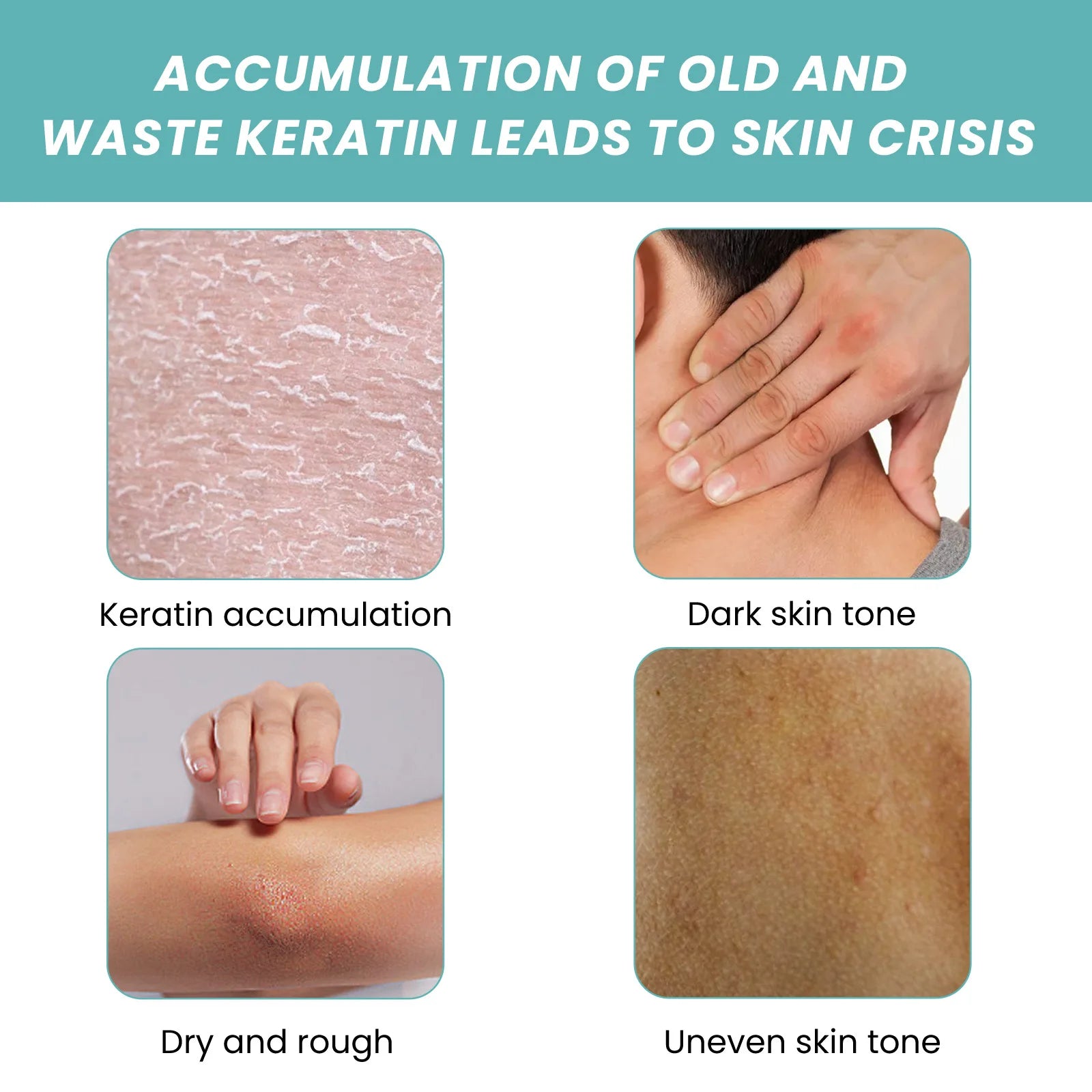 Eelhoe 100ml Body Cleansing Bath Oil Exfoliator Moisturizing Skin Repairing Brighten Body Wash Skin Exfoliating Dirt Shower Oil