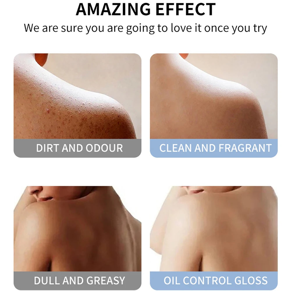 1000ml Kojic Acid Shower Gel Deep Cleansing Brighten Skin Body Wash Skin Whitening Exfoliator Body Care Moisturizing Skincare